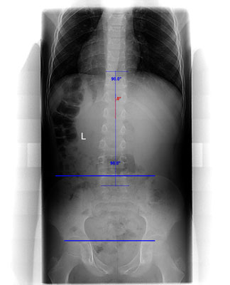 Christian_Pailadiino_XRAY1