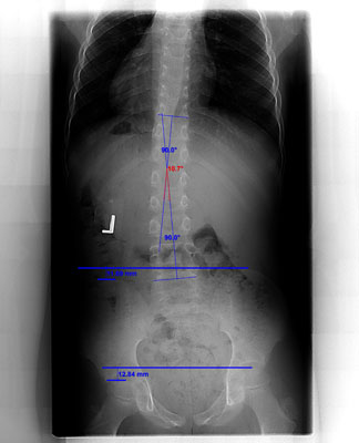 Christian_Pailadiino_XRAY2