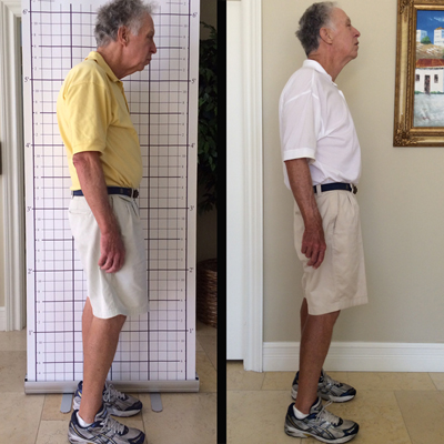 Poor Posture